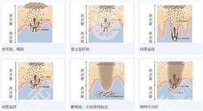 光伏龙头ETF广发(图1)