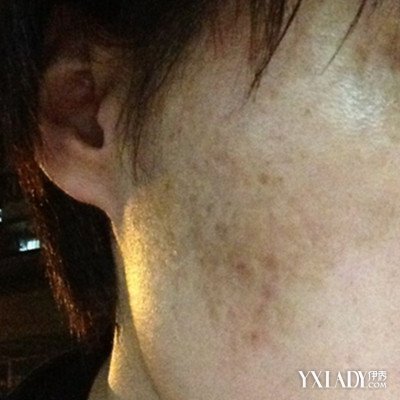 妆械美学雅诗兰黛旗下全球首款「重组PDRN」水光系列在中国首发(图1)