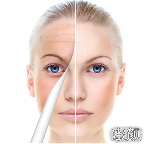 激光行业资讯_激光产业新闻热点报道-OFweek网(图1)
