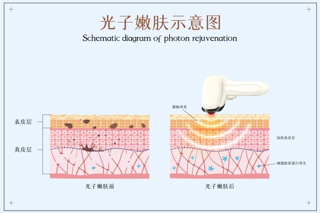 上海美莱怎么预约?准备去面诊的人可以提前了解这些方式(图1)