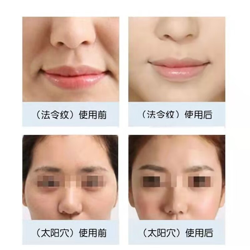 干细胞回输百日记：我和抗衰老的亲密接触(图1)