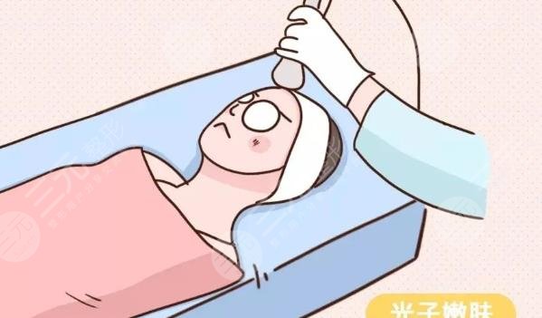 光子嫩肤的价格(图1)