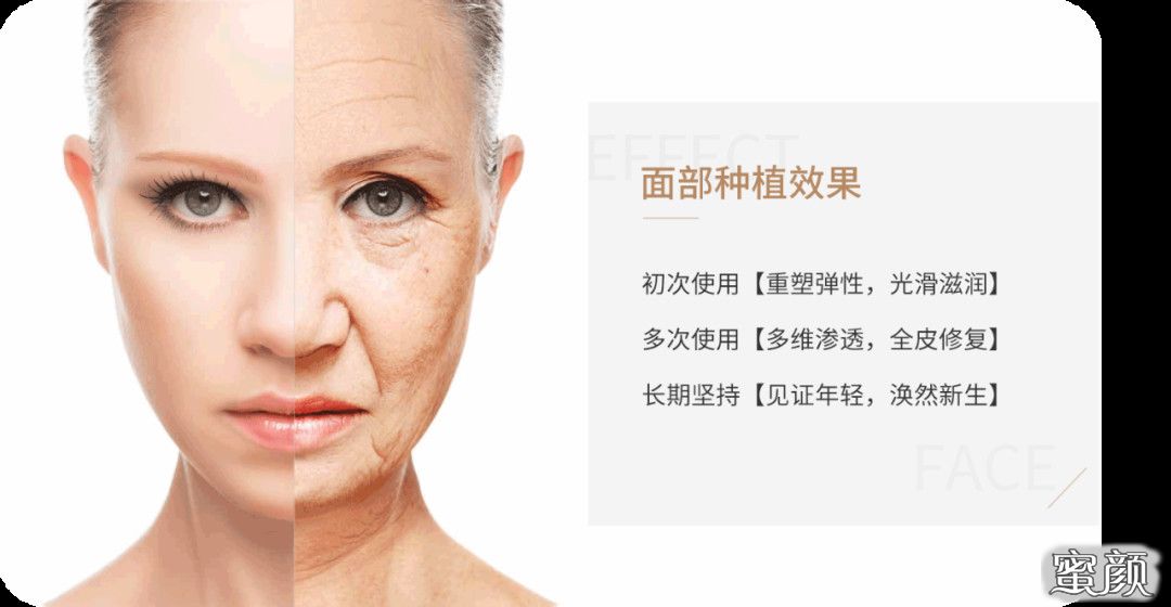 千亿抗衰赛道干细胞成为抗衰主力军后附3项60例临床案例CellPress干细_财富号_东方财富网(图1)