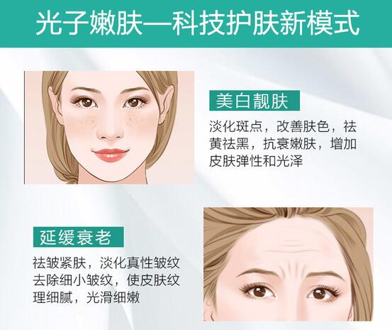 光子嫩肤多少钱一次?做这个有限制吗?(图1)
