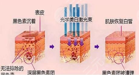 皮肤光电美容培训(图1)