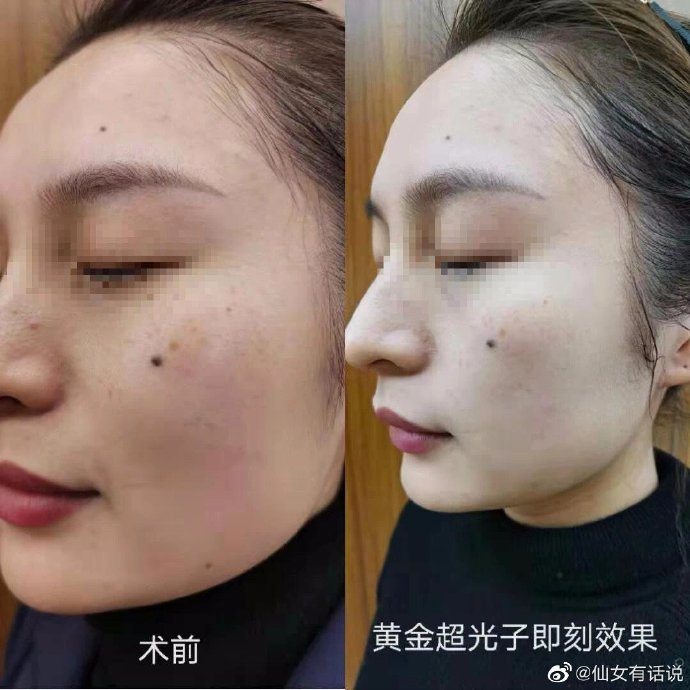 河北：医疗美容盛行当心“江湖游医”！