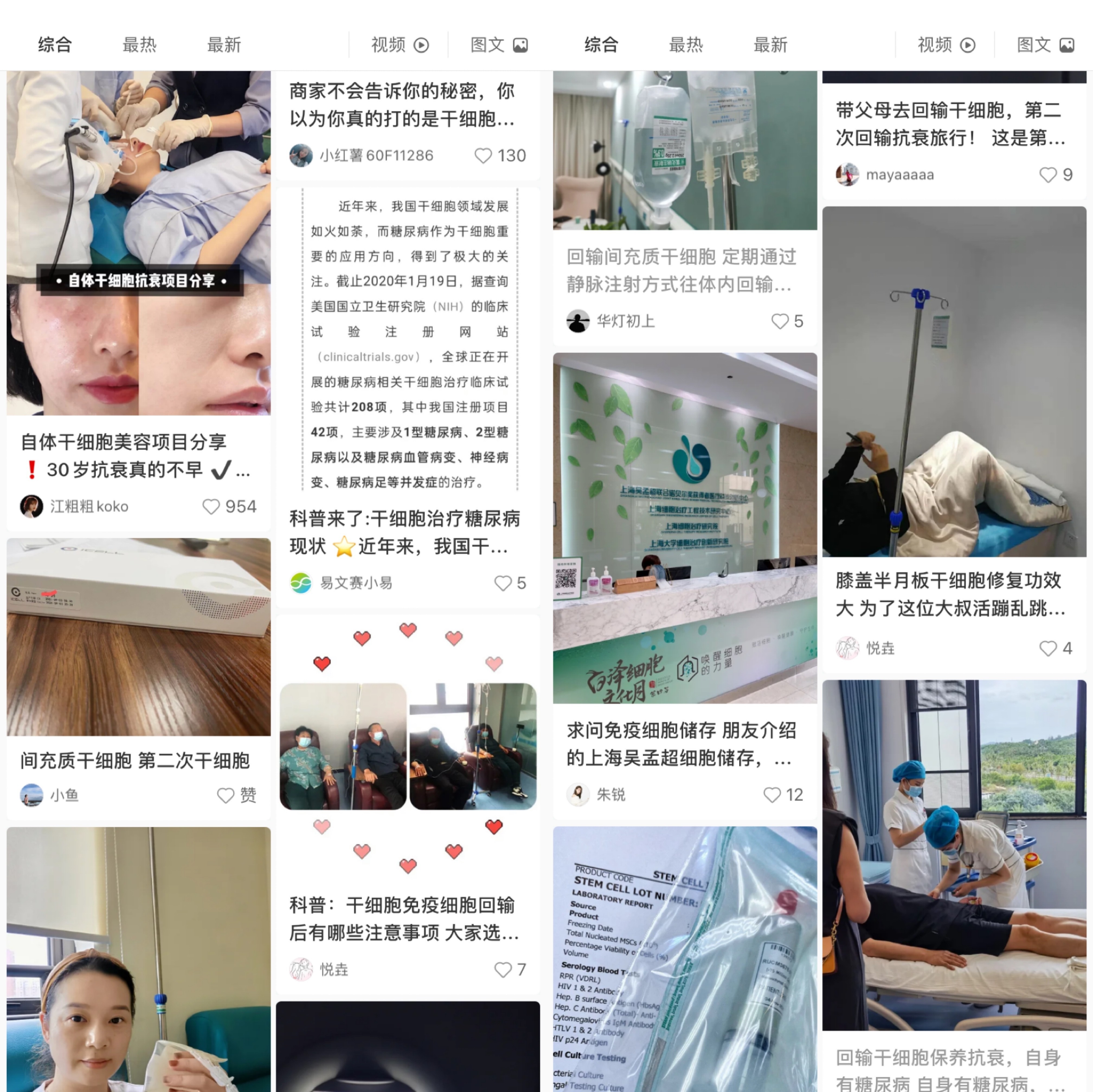 干细胞注射抗衰老的作用(图1)